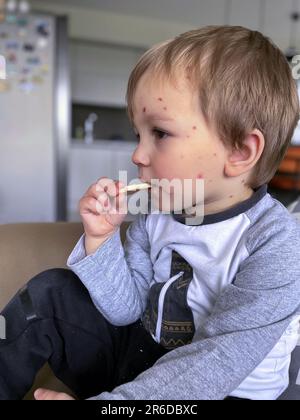 Portrait d'un petit tout-petit avec un biscuit de consommation de varicelle Banque D'Images