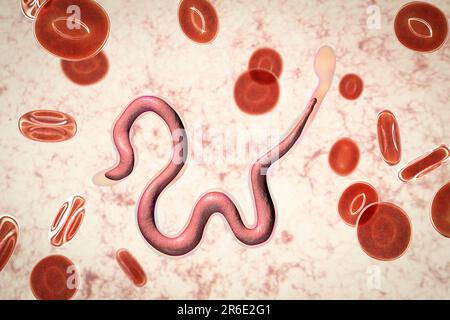 Brugia malayi ordinateur illustration d'un ver nématode parasitaire et cause des droits de la filariose lymphatique (éléphantiasis). Brugia malayi est l'un des cinq Banque D'Images