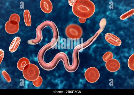 Brugia malayi ordinateur illustration d'un ver nématode parasitaire et cause des droits de la filariose lymphatique (éléphantiasis). Brugia malayi est l'un des cinq Banque D'Images