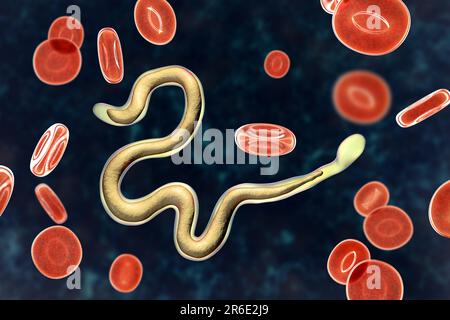 Brugia malayi ordinateur illustration d'un ver nématode parasitaire et cause des droits de la filariose lymphatique (éléphantiasis). Brugia malayi est l'un des cinq Banque D'Images