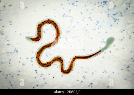 Brugia malayi ordinateur illustration d'un ver nématode parasitaire et cause des droits de la filariose lymphatique (éléphantiasis). Brugia malayi est l'un des cinq Banque D'Images