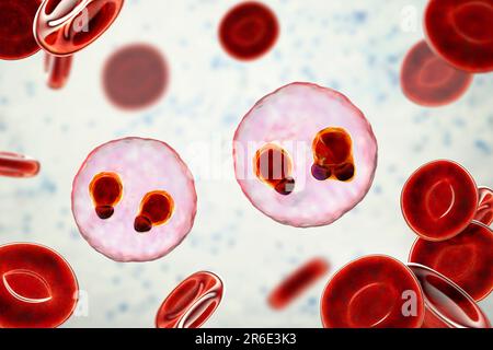 Protozoaire Plasmodium falciparum à l'intérieur des globules rouges, illustration informatique. P. falciparum est l'agent causal du paludisme Tertien malin, également connu Banque D'Images