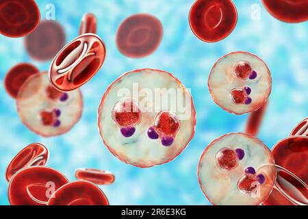 Protozoaire Plasmodium falciparum à l'intérieur des globules rouges, illustration informatique. P. falciparum est l'agent causal du paludisme Tertien malin, également connu Banque D'Images