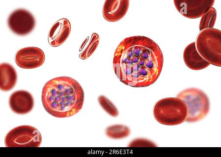 Protozoaire Plasmodium vivax à l'intérieur des globules rouges, illustration informatique. P. vivax est l'agent causal du paludisme Tertien Bénin transmis à l'homme b Banque D'Images