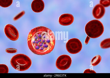 Protozoaire Plasmodium vivax à l'intérieur des globules rouges, illustration informatique. P. vivax est l'agent causal du paludisme Tertien Bénin transmis à l'homme b Banque D'Images