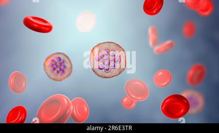 Protozoaire Plasmodium vivax à l'intérieur des globules rouges, illustration informatique. P. vivax est l'agent causal du paludisme Tertien Bénin transmis à l'homme b Banque D'Images