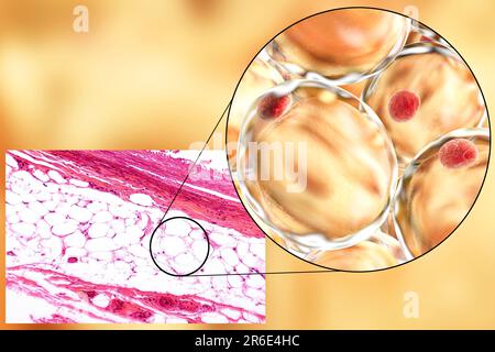 Cellules graisseuses, micrographe léger et illustration informatique. Tissu adipeux blanc composé d'adipocytes (cellules graisseuses). Les adipocytes forment le tissu adipeux, qui Banque D'Images