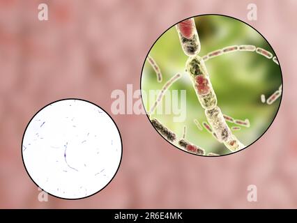 Bactéries anthrax, micrographe léger et illustration informatique. La bactérie de l'anthrax (Bacillus anthracis) est la cause de la maladie de l'anthrax chez les humains et Banque D'Images