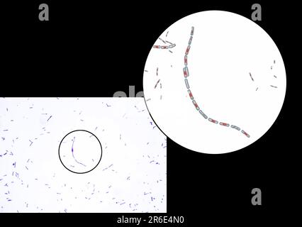 Bactéries anthrax, micrographe léger et illustration informatique. La bactérie de l'anthrax (Bacillus anthracis) est la cause de la maladie de l'anthrax chez les humains et Banque D'Images