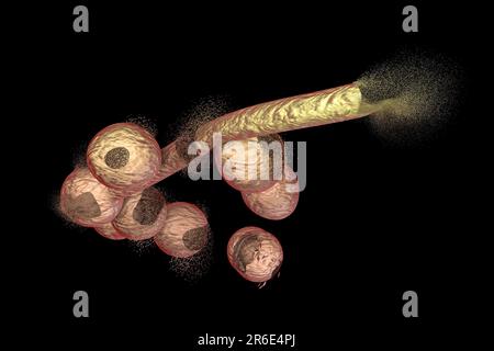 La destruction des champignons Candida, illustration de l'ordinateur. Image peut être utilisé pour illustrer le concept de traitement antifongique. Banque D'Images