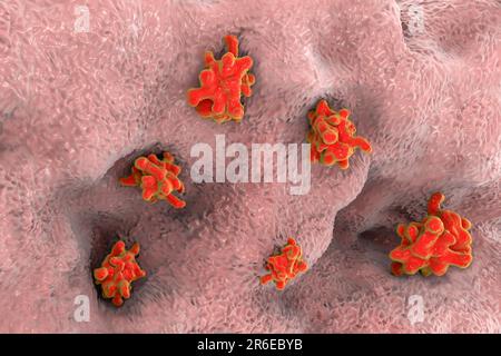 L'amibe parasite (Entamoeba histolytica) provoque une dysenterie amibienne et des ulcères (stade trophozoïte végétatif), illustration informatique. La dysenterie amibienne est Banque D'Images