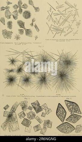 'Les maladies rénales, les dépôts urinaires et les troubles calculs : leur nature et leur traitement' (1870) Banque D'Images