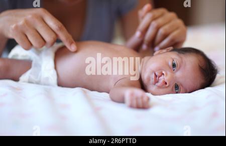 Soins, portrait et un bébé avec un palais de fente étant changé, jouant et les mains d'une mère avec amour. Famille, santé et un nouveau-né avec un Banque D'Images