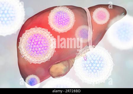 Avec du foie hépatite et close-up view of hepatitis C virus, illustration. Banque D'Images