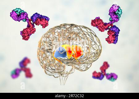 Anticorps anti-ganglionnaires basaux (ABGA). Illustration informatique conceptuelle montrant des molécules d'immunoglobulines attaquant le striatum dorsal mis en évidence dans t Banque D'Images