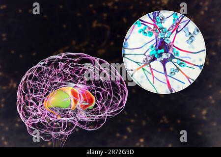 Anticorps anti-ganglionnaires basaux (ABGA). Illustration informatique conceptuelle montrant des molécules d'immunoglobulines attaquant le striatum dorsal mis en évidence dans t Banque D'Images