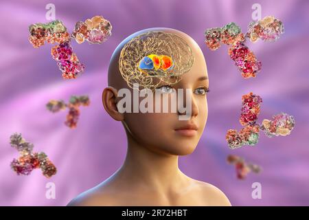 Anticorps anti-ganglionnaires basaux (ABGA). Illustration informatique conceptuelle montrant des molécules d'immunoglobulines attaquant le striatum dorsal mis en évidence dans t Banque D'Images