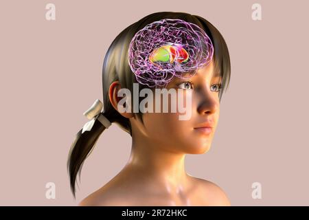 Striatum dorsal mis en évidence dans le cerveau de l'enfant et vue rapprochée de ses neurones, illustration informatique. C'est un noyau dans les ganglions basaux, un composant Banque D'Images