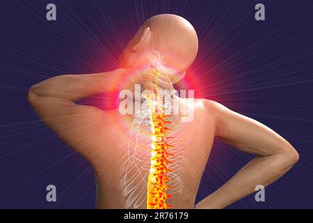 Les droits de la douleur au cou, l'oeuvre de l'ordinateur. Banque D'Images