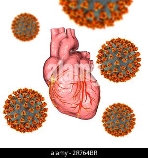 Virus COVID-19 affectant le cœur, illustration conceptuelle 3D. L'inflammation du coeur et d'autres organes peut être une complication de Covid-19, une resp Banque D'Images