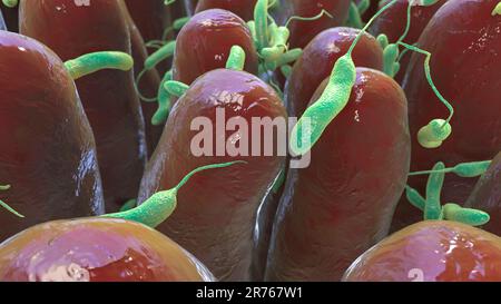 Bactérie du choléra (Vibrio cholerae) dans l'intestin grêle humain, illustration informatique. Banque D'Images