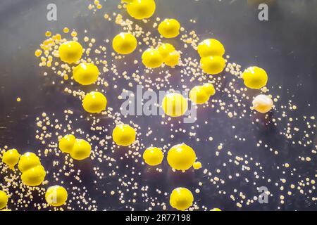 Bactéries cultivées à partir d'un frottis cutané, colonies de Micrococcus luteus et de Staphylococcus epidermidis sur gélose trypticase soja. Banque D'Images