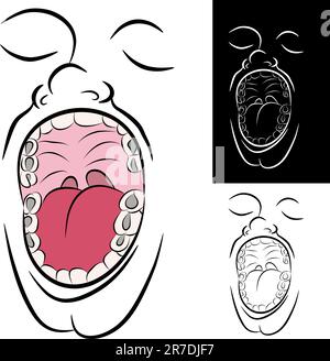 L'image d'une bouche avec metal obturations dentaires. Illustration de Vecteur