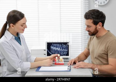 Médecin montrant le modèle éducatif du patient de l'implant dentaire en clinique Banque D'Images