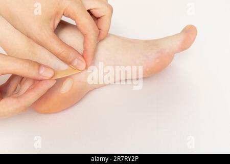 Personne applique le plâtre adhésif sur les callosités du pied, les fougères de la peau sur le talon et le Phalange de l'orteil. L'eau la maladie de Blister sur les pieds. Callosité douloureuse avant Banque D'Images