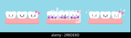 Blanc mignon dent et avec tartre jaune avant après l'ensemble d'icônes de test de plaque. Kawaii dents dans le traitement des taches de gomme, enlever et nettoyer, concept de blanchiment Illustration de Vecteur