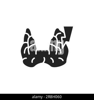 Icône de la ligne de couleur du médecin de l'hyperthyroïdie. Elément vectoriel isolé. Pictogramme de contour pour la page Web, l'application mobile, la promotion Illustration de Vecteur