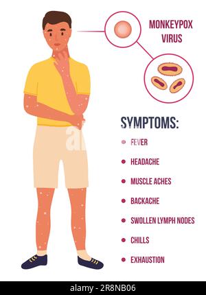 Jeune homme caucasien avec beaucoup de papules en raison de la pandémie du virus de la pox de singe. Diagramme de cellules de virion. symptômes fièvre, maux de tête. Illustration de Vecteur