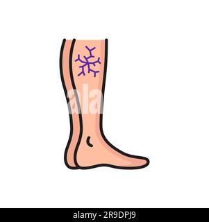 Varices, jambe avec icône de contour de filet vasculaire. Inflammation vectorielle douleur de pression artérielle anormale, valves faibles. Diagnostic et traitement des maladies vasculaires Illustration de Vecteur