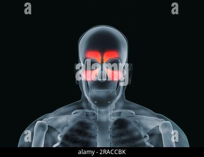 Image radiographique de l'homme montrant des cavités nasales sur fond noir, illustration Banque D'Images