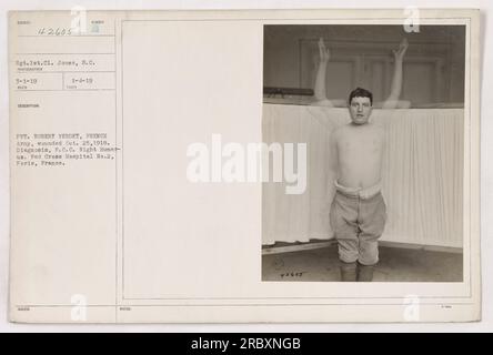 Le soldat Robert Verdet, soldat de l'armée française, a été photographié à l'hôpital No 2 de la Croix-Rouge à Paris, France le 4 janvier 1919. Il a été blessé le 25 octobre 1918, avec un diagnostic de F.C.C. (signification exacte inconnue) Humérus droit. La photographie a été prise par le sergent Jones de 1e classe. [Authentification : 111-SC-42605] Banque D'Images