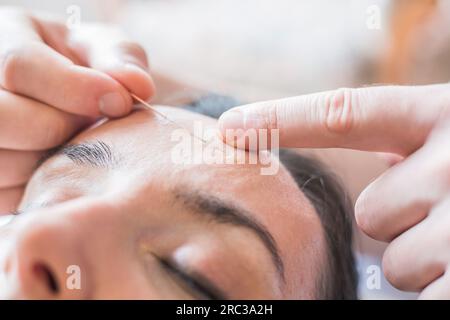 Jeune femme caucasienne ayant des séances d'acupuncture sur son visage comme traitement de beauté, anti-âge. Concept de vieillissement contrôlé et de beauté et de soins du corps. Banque D'Images