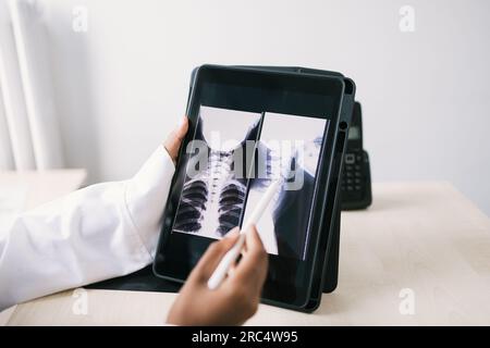 Gros plan de la culture afro-américaine médecin dans les images de rayon de contrôle uniforme de la moelle épinière sur tablette à la lumière du jour Banque D'Images