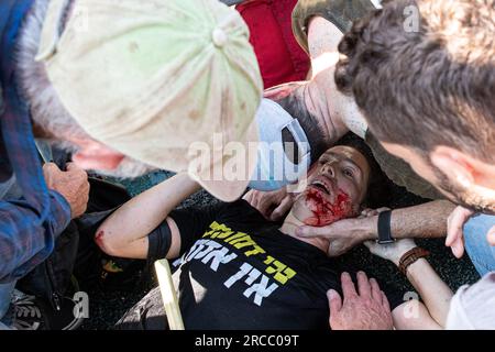 Jérusalem, Israël. 11 juillet 2023. Un manifestant blessé est vu lors d'une manifestation de réservistes israéliens contre la réforme judiciaire au cours de laquelle des manifestants ont bloqué l'autoroute tel Aviv - Jérusalem à la jonction Ein Hemed. (Image de crédit : © Matan Golan/SOPA Images via ZUMA Press Wire) USAGE ÉDITORIAL SEULEMENT! Non destiné à UN USAGE commercial ! Banque D'Images
