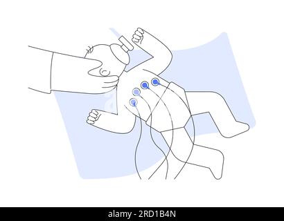 Illustration vectorielle abstraite de la chirurgie néonatale. Illustration de Vecteur