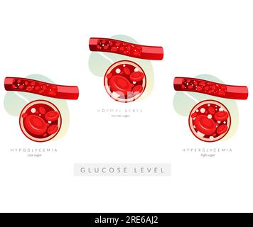 Globules rouges - niveau de glucose - Illustration stock sous forme de fichier EPS 10 Illustration de Vecteur