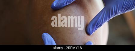 Dermatologue vérifiant la pigmentation de la peau du patient à l'hôpital. Banque D'Images