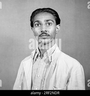 Vieux vintage des années 1900 noir et blanc portrait studio de l'homme indien petite variole marque l'Inde des années 1940 Banque D'Images