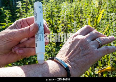 Femme appliquant un médicament à partir d'un applicateur pour apaiser une piqûre d'ortie ou une piqûre d'insecte sur son bras. Banque D'Images