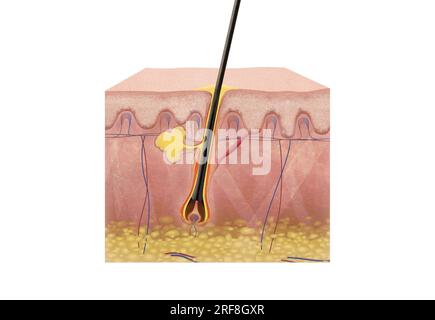 Section de peau 2D avec des cheveux sains (par opposition au bouton) avec épiderme, derme et hypoderme, glande sébacée, muscle arrecteur. Banque D'Images