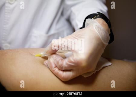 Traitement de la cellulite et des vergetures par carboxythérapie, ou injection sous-cutanée de dioxyde de carbone. Banque D'Images