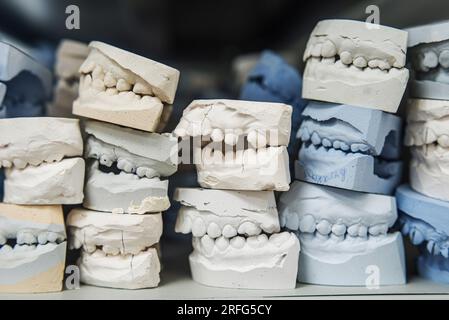 Lieu de stockage des modèles de plâtre des mâchoires humaines dans une clinique orthodontique. Moulages dentaires de contrôle et de diagnostic Banque D'Images