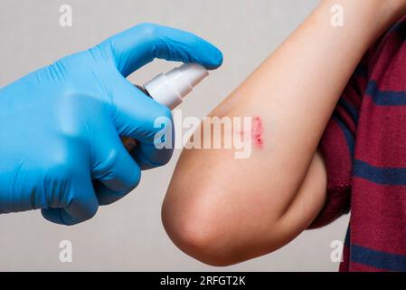 Womans Hand vaporise un agent antiseptique sur la plaie sur la main de l'enfant Banque D'Images