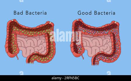 Mauvaises bactéries et bonnes bactéries. Une illustration du biome humain dans le gros intestin avec texte. Banque D'Images