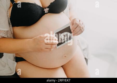 Jeune femme enceinte avec le ventre et le papier à ultrasons babys en main, concept de grossesse Banque D'Images