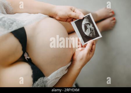 Jeune femme enceinte avec le ventre et le papier à ultrasons babys en main, concept de grossesse Banque D'Images